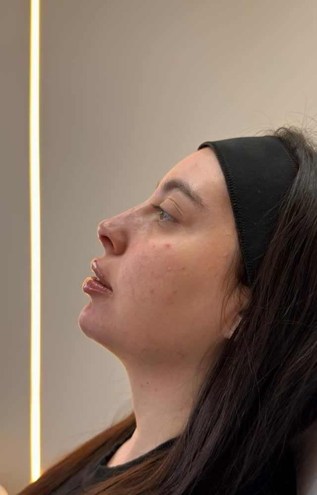 Avaliação de perfil facial